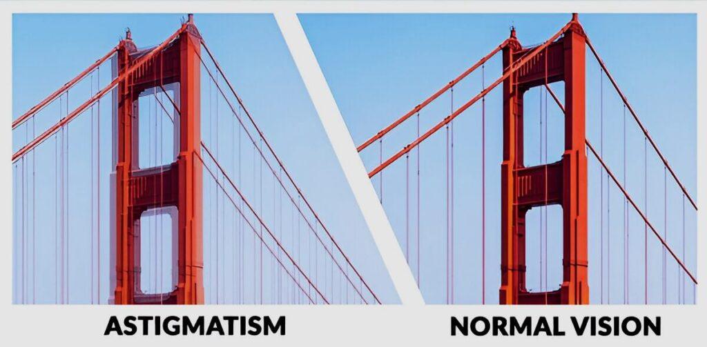 Astigmatism vs. Normal Eyesight