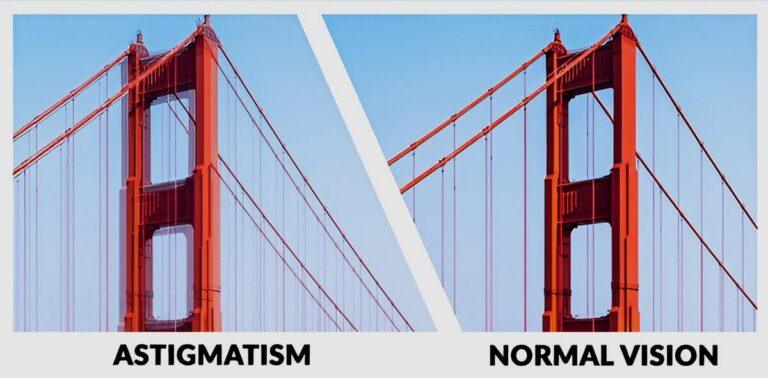 Astigmatism vs. Normal Eyesight