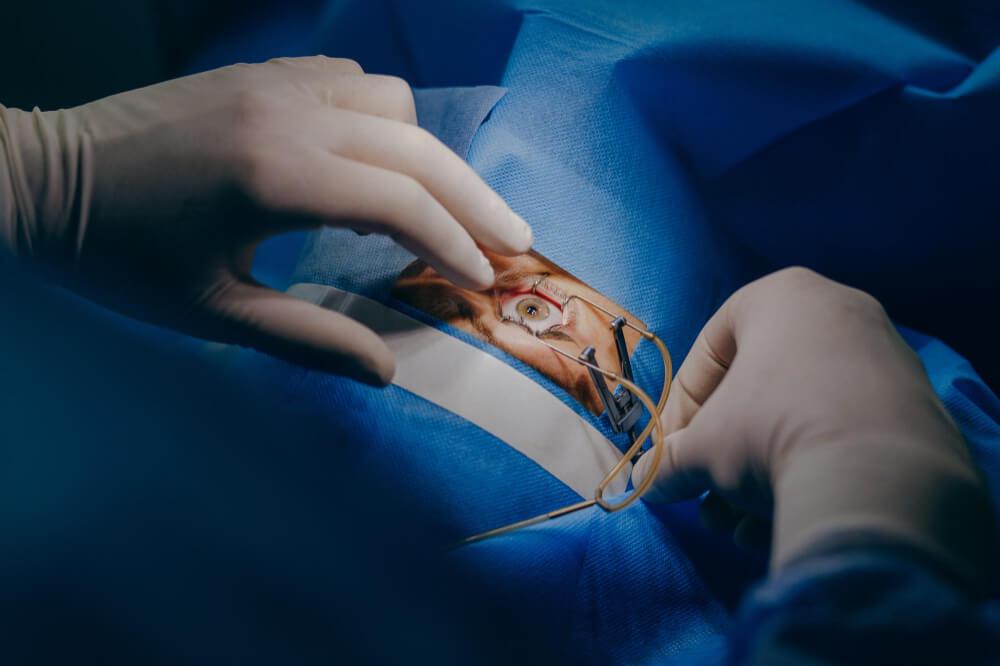 How Long Do LASIK Surgery Results Last